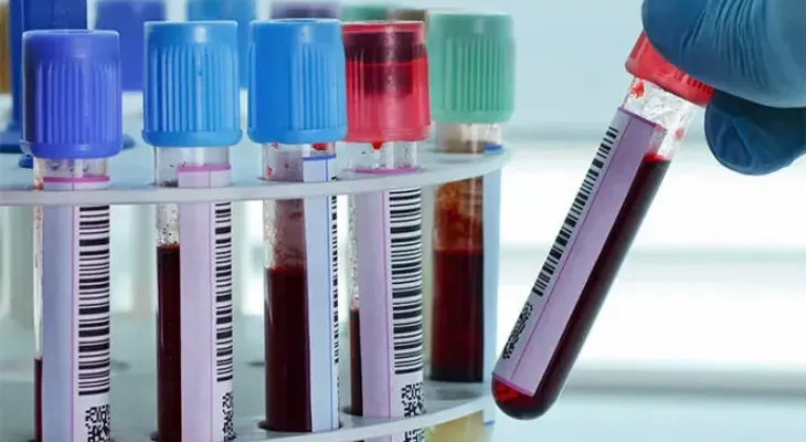 Un test con una simple gota de sangre permitirá detectar a tiempo 50 tipos de cáncer