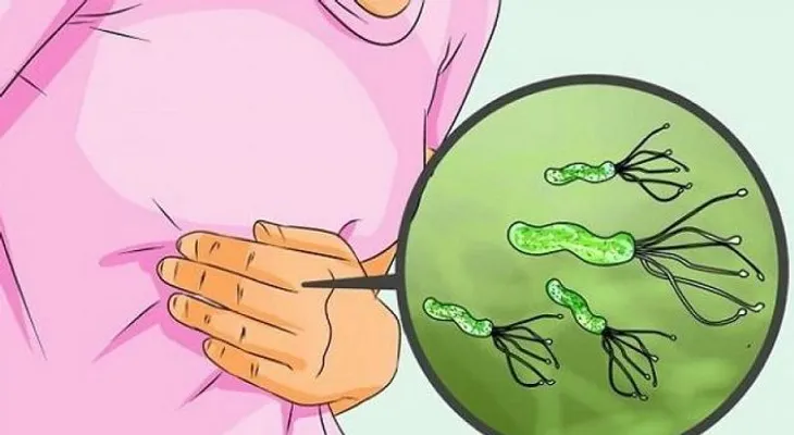 Médico japonés publica cómo eliminar la bacteria Helicobacter Pylori fácilmente 