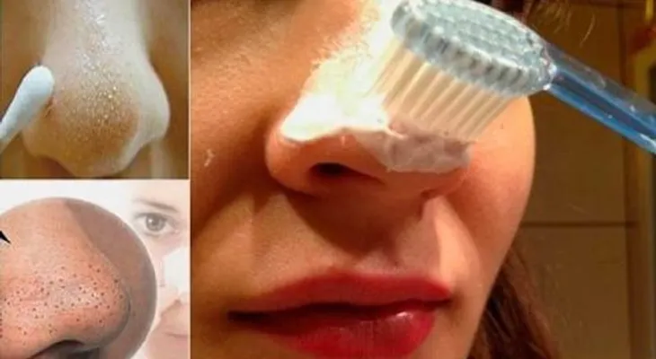 Frota tu naríz 5 minutos con pasta dental y algo INCREIBLE pasarás 