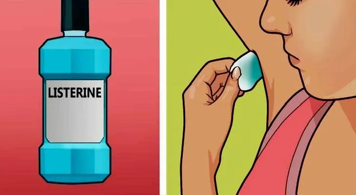 Sólo tiene que colocar un algodón mojado con en listerine bajo los brazos. El resultado es sorprendente!
