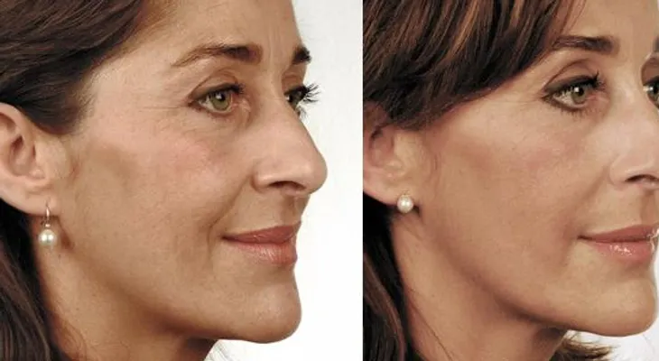 No deje que su cuello delate su edad, 6 trucos de belleza para las arrugas