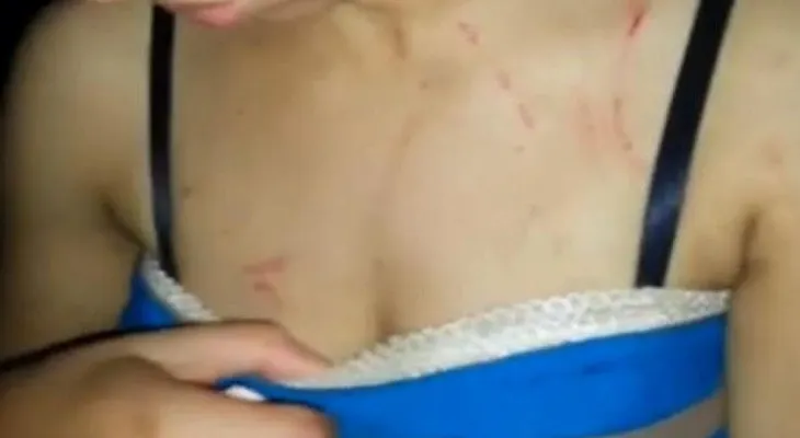 Joven denuncia fue agredida por vecino que dice estar pegado con el Gobierno 