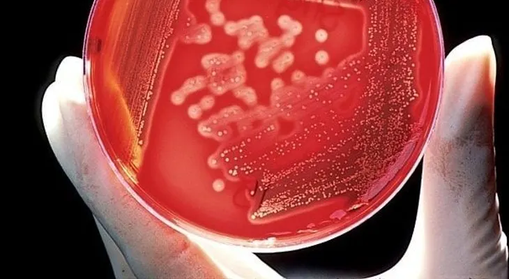 Nueva combinación para la gonorrea resistente al tratamiento