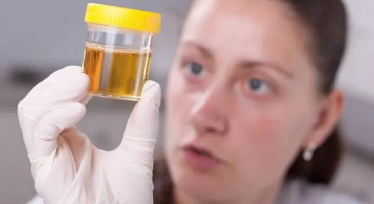 Qué dice el color de tu orina sobre tu salud