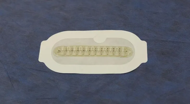 La tecnología médica avanza sin límites: Un dispositivo curaría heridas sin usar hilo ni aguja 