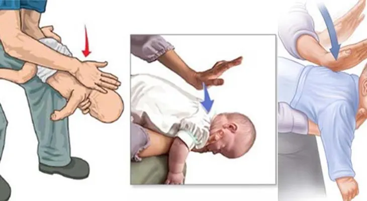 Los pasos a seguir si un niño se está ahogando con un alimento