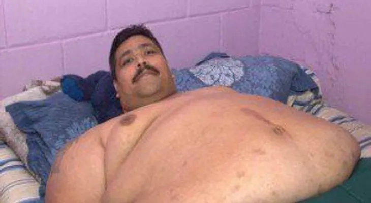 El hombre más obeso del mundo comienza a adelgazar tras exitosa operación