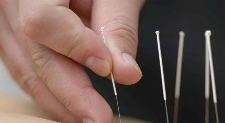 Encuesta Ciencia: La mitad de los españoles confía en acupuntura y homeopatía