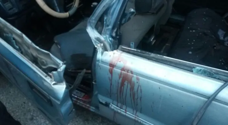 Camión desprende brazo izquierdo de chofer de carro público al rebasarle