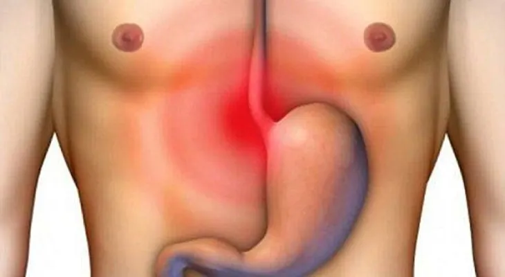 En 7 días y para siempre elimina la acidez y gastritis 