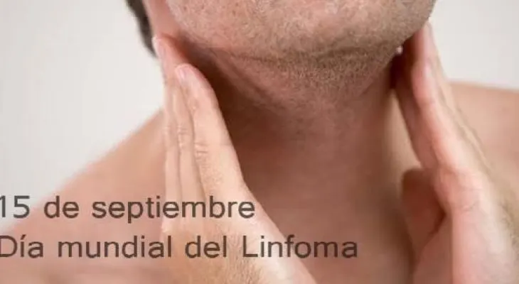El linfoma es la cuarta malignidad más frecuente en Venezuela