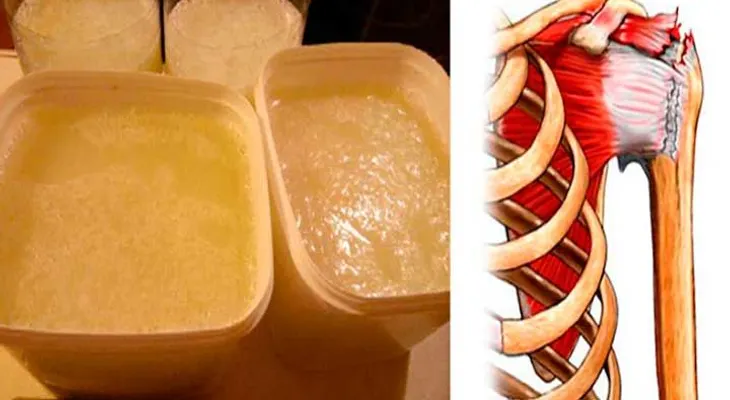 Elixir especial para rehabilitar con éxito los tendones y ligamentos de las rodillas