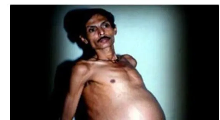 ¡Entérate del insólito caso médico de este hombre!
