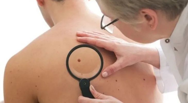 5 razones sorpresivas para visitar al dermatólogo
