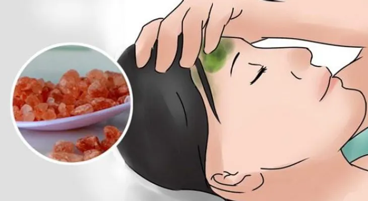 Cómo curar las migrañas en 30 segundos con este método totalmente natural