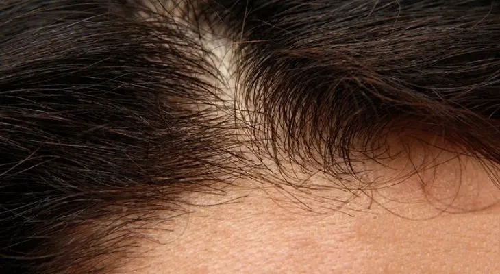 Cómo fortalecer el cuero cabelludo de forma natural