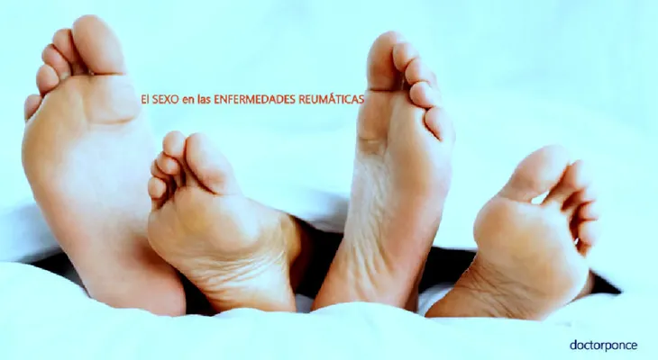 ¿Cómo afectan las enfermedades reumáticas a la sexualidad? 