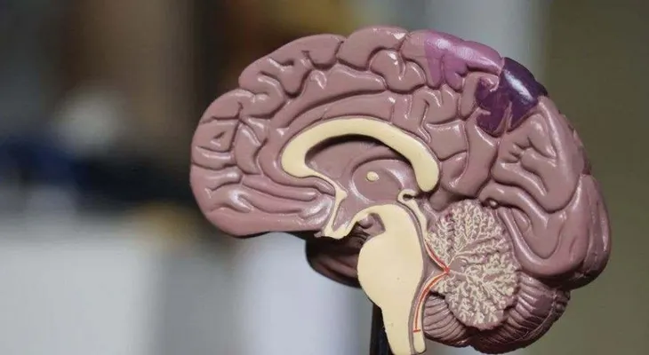Pacientes pueden sufrir daños en el cerebro por COVID-19