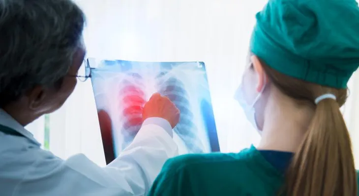 Especialista destaca la detección temprana del cáncer de pulmón tras el caso del papa León XIV