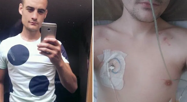 Un joven con rara enfermedad no puede ir al baño 