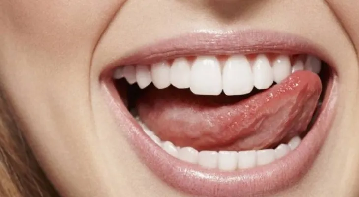 Los 10 alimentos muy habituales que destrozan tus dientes