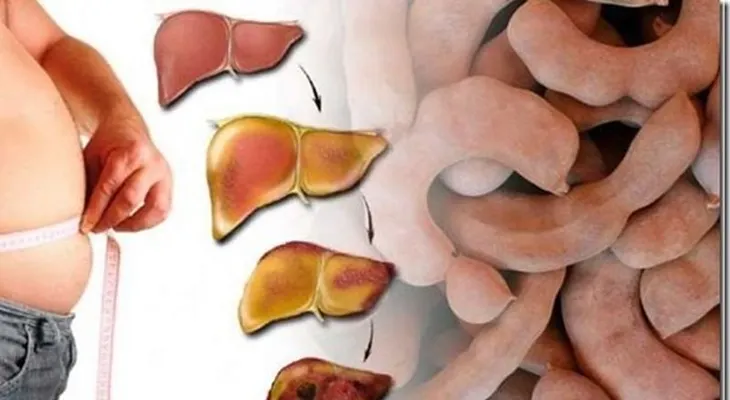 Es increíble como esta fruta hace desaparecer el hí­gado graso 