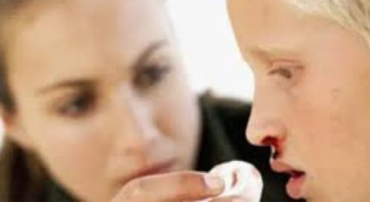 La hemofilia afecta a 1 de cada 5 ó 10 mil hombres