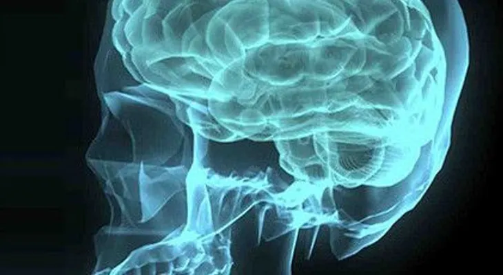 Hallan el gen que hace al cerebro humano único