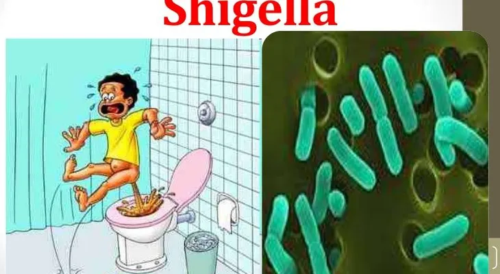 Importante: Síntomas de la bacteria Shigella