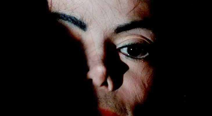 Michael Jackson y los escalofriantes detalles de la autopsia. Calvo y con cicatrices en todo el cuerpo. 