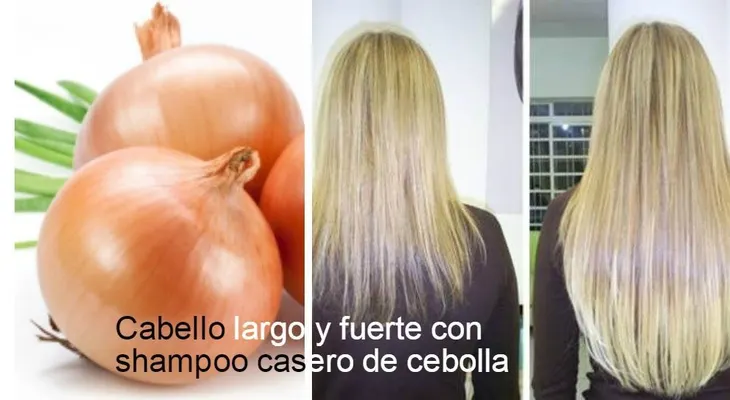 Cómo haber champú de cebolla, para que el pelo crezca de forma rápida y saludable