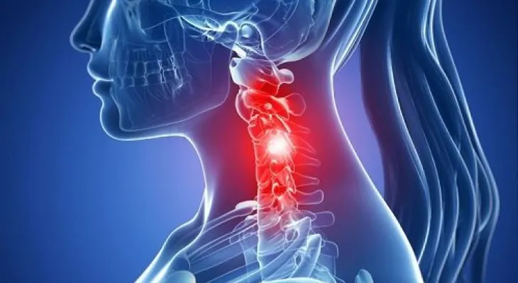 6 ejercicios para eliminar el dolor cervical