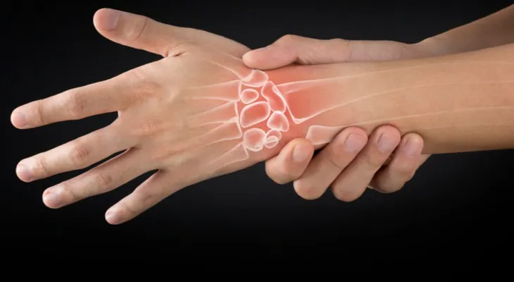 La artritis reumatoide es una enfermedad que "te enseña a vivir con el dolor"