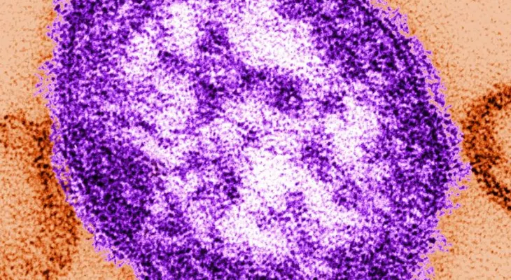 Mujer de 40 años muere por complicaciones del sarampión en Pensilvania