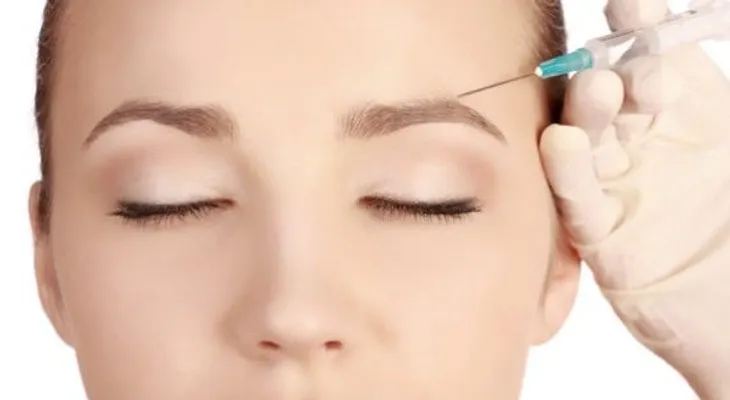   ¿Te pusiste botox? Mira lo que va a durar