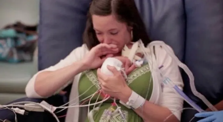 Video: ¡Extraño! Bebé con envejecimiento prematuro