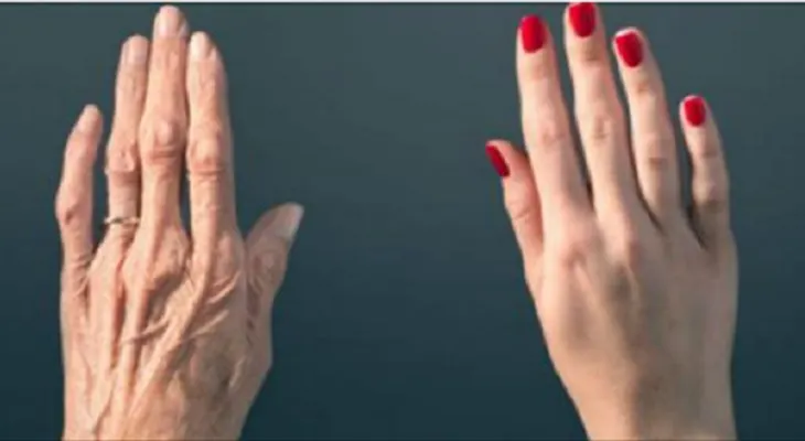 Tus manos revelan tu edad! Descubre cómo parar eso!