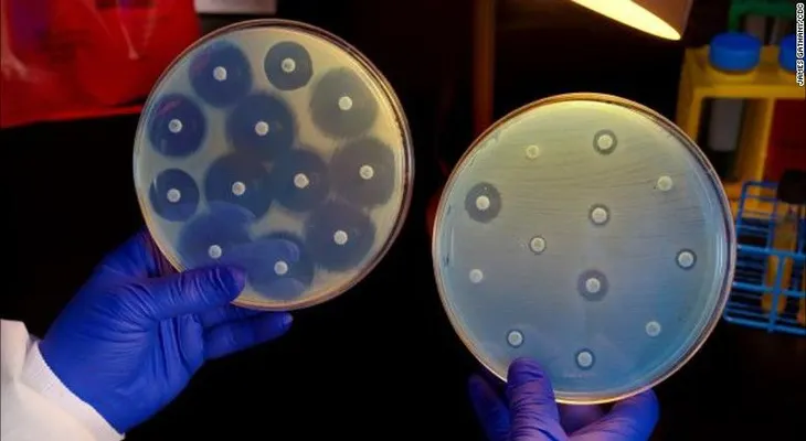 ¿Por qué mandan al espacio una superbacteria resistente a los antibióticos?