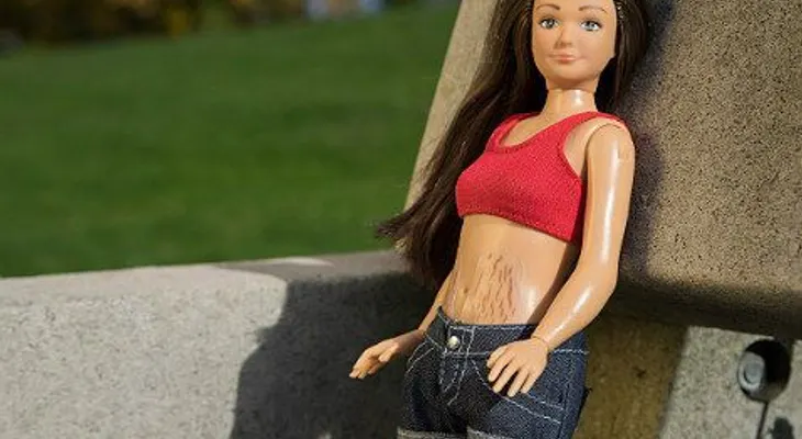 Sale a la venta una muñeca con estrías y celulitis
