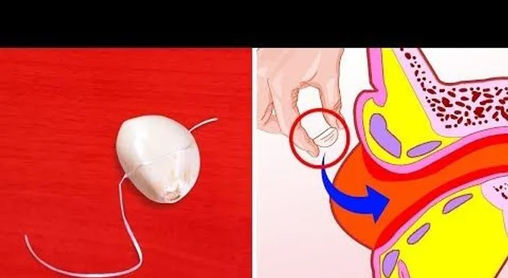 El ajo tiene propiedades médicas INCREIBLES: Cómelo todos los días y mira lo que sucede