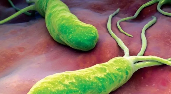 Cómo luchar contra la bacteria que causa ardor, diarrea e hinchazón