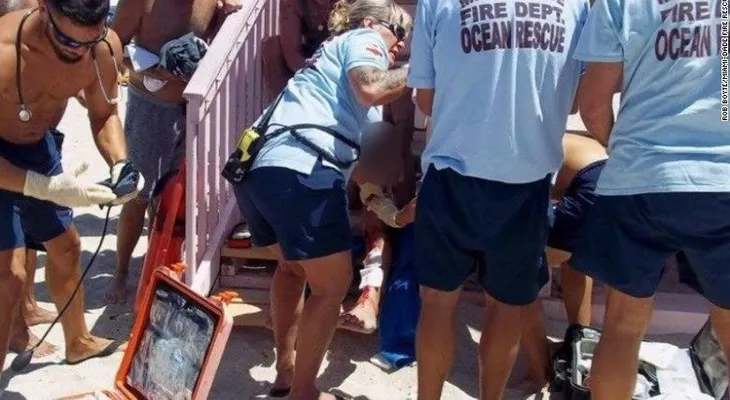 Un tiburón ataca a un bañista en el área de Miami Beach