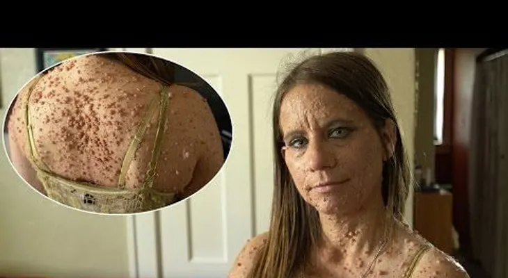 Los hombres sienten miedo de acercarse a ella. Pero a los 16 años nunca hubiera imaginado esta pesadilla