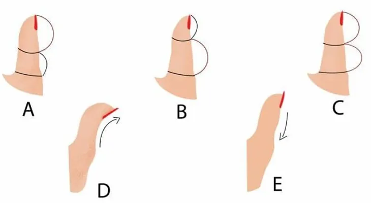 La forma de tu pulgar y lo que revela sobre tu personalidad