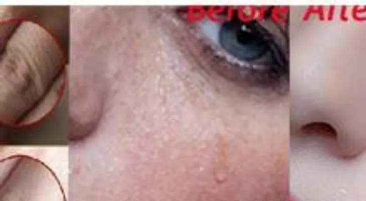  Colócate esta mascarilla en la noche y despierta como un príncipe o una princesa 