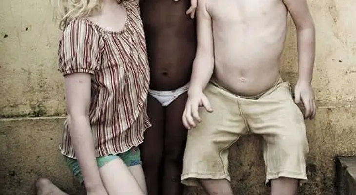 3 hijos albinos tiene una madre de color (Video)