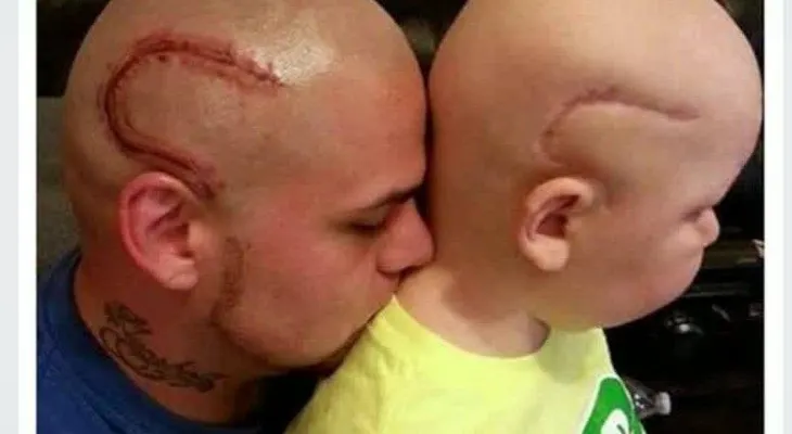 Padre se tatúa la cicatriz de su hijo para apoyarlo en su lucha contra el cáncer