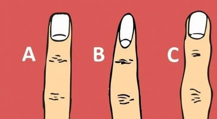 Dime cómo la forma de tus falanges y te diré algo impresionante sobre tu salud y personalidad