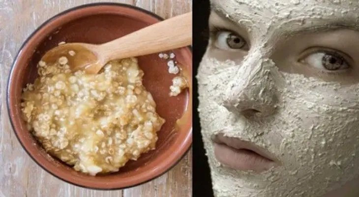 7 días: quita manchas de tu piel, con esta maravillosa mascarilla!