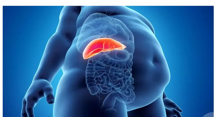Microbiota influye en gravedad del hígado graso